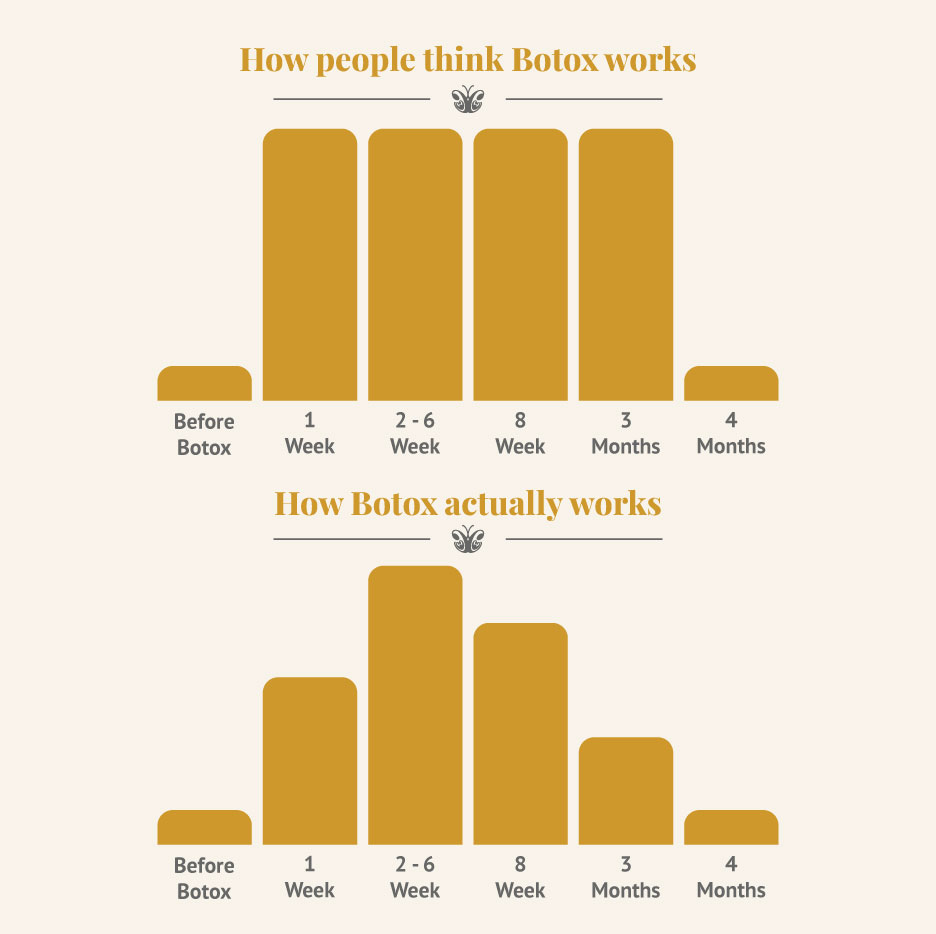 How Botox work over time grafic