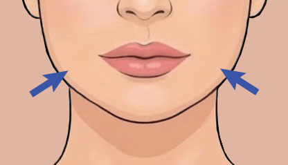 Illustration of Jawline Slimming
