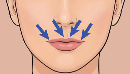 Illustration of Lip Flip.